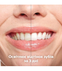 Philips Щетка зубная электр., Sonicare DiamondClean 9000 Series набор, 62т. колеб/мин, насад